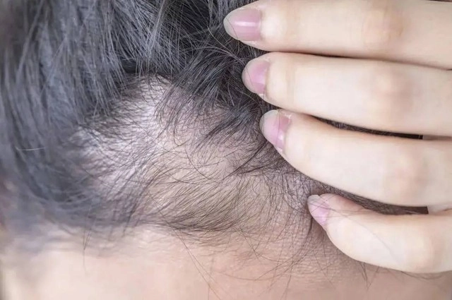 Thói quen vô tình khiến tóc không kiểm soát